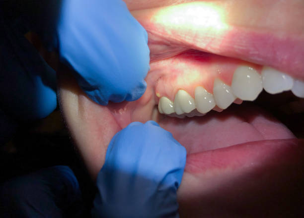 Best Emergency Broken Tooth Repair in Genoa City, WI